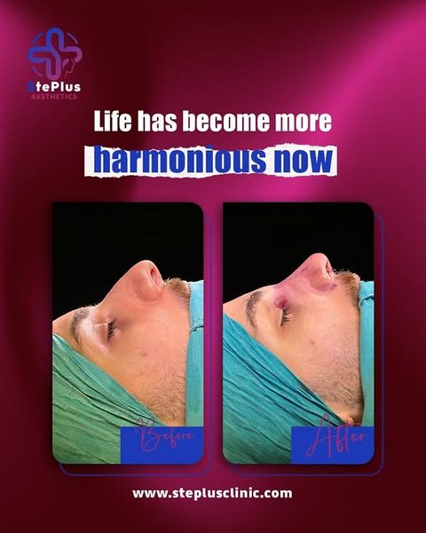 StePlus Clinic post on Instagram