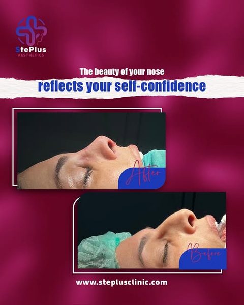 StePlus Clinic post on Instagram